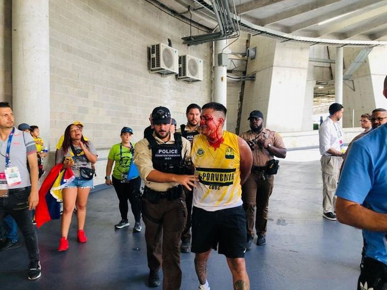 FOTO: Un hincha colombiano es retirado ensangrentado. (Foto: Twitter).